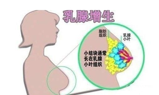 乳房出現(xiàn)“青筋”是什么原因呢？