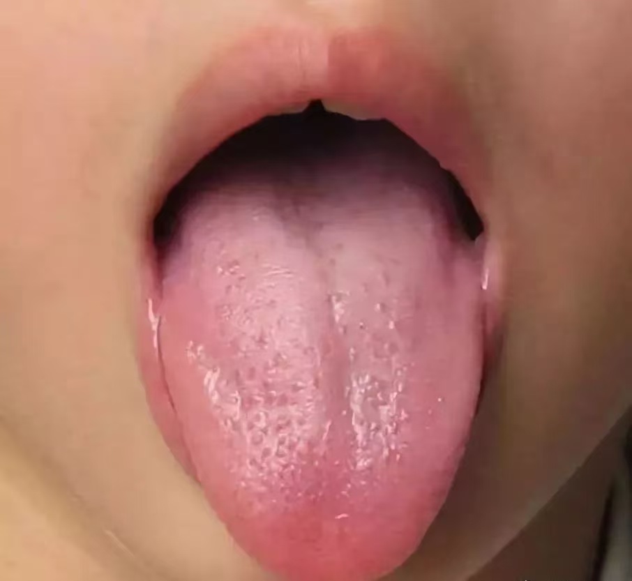 過度喂養(yǎng)危害大，寶寶發(fā)出的積食信號(hào)你能看懂多少？