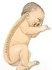 【母嬰知識】“頭”等大事，新生兒枕頭使用須知！