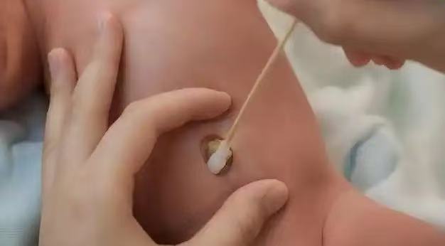  肚臍眼里的污垢，到底能不能摳？ 