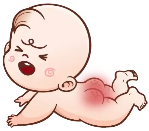 預(yù)防寶寶紅屁股四大實(shí)用技巧  