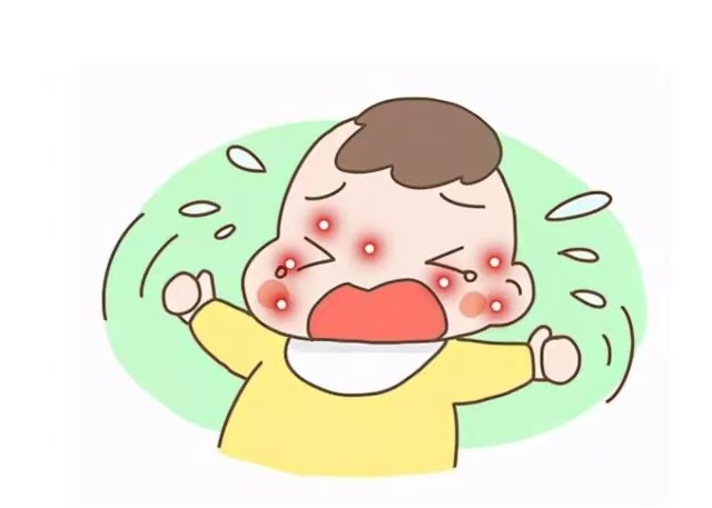孩子濕疹反復(fù)發(fā)作怎么辦？這些防治方法請(qǐng)收好！